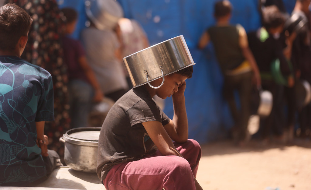 طفل يضع إناء في رأسه ليقيه من حر الشمس بينما ينتظر دوره للحصول على وجبة قليلة من العدس 